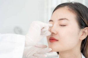 rhinoplasty