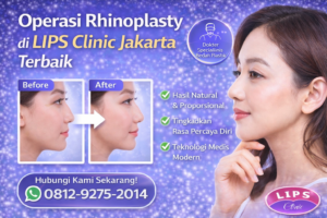 operasi rhinoplasty terbaik