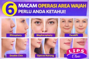 operasi area wajah