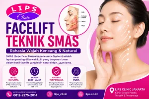 Facelift Teknik SMAS untuk wajah lebih kencang dan natural di LIPS Clinic Jakarta
