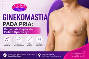 Ginekomastia pada pria dan prosedur operasi pengecilan dada dengan liposuction di Jakarta