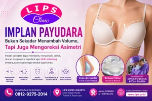 Implan Payudara untuk Menambah Volume dan Mengoreksi Asimetri – LIPS Clinic Jakarta