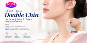 Sedot lemak double chin untuk mengurangi lemak di bawah dagu – LIPS Clinic Jakarta