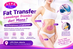 Fat Transfer diambik darimana?
