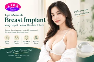 Breast Implant Jakarta LIPS Clinic – Tips Memilih Implan Payudara Sesuai Bentuk Tubuh