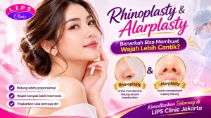 Dokter LIPS Clinic menjelaskan rhinoplasty dan alarplasty